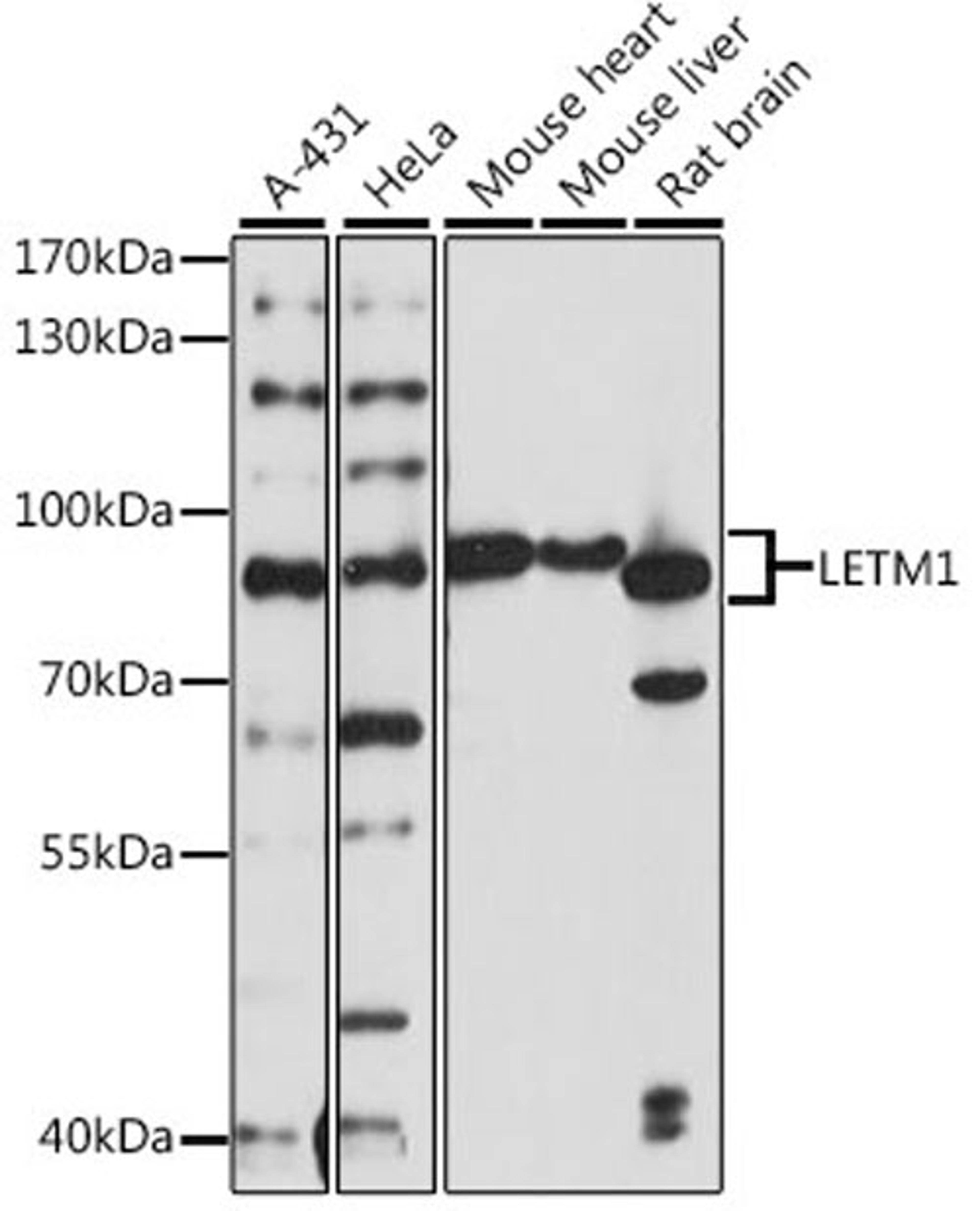 Western blot - LETM1 antibody (A15685)