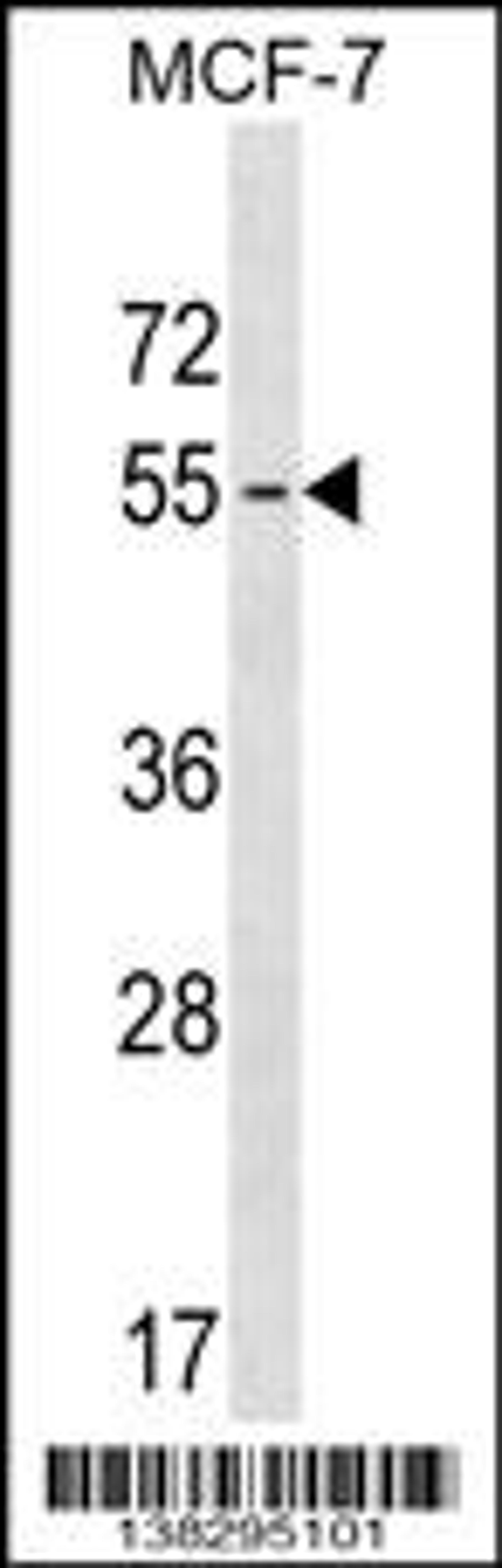 Western blot analysis in MCF-7 cell line lysates (35ug/lane).