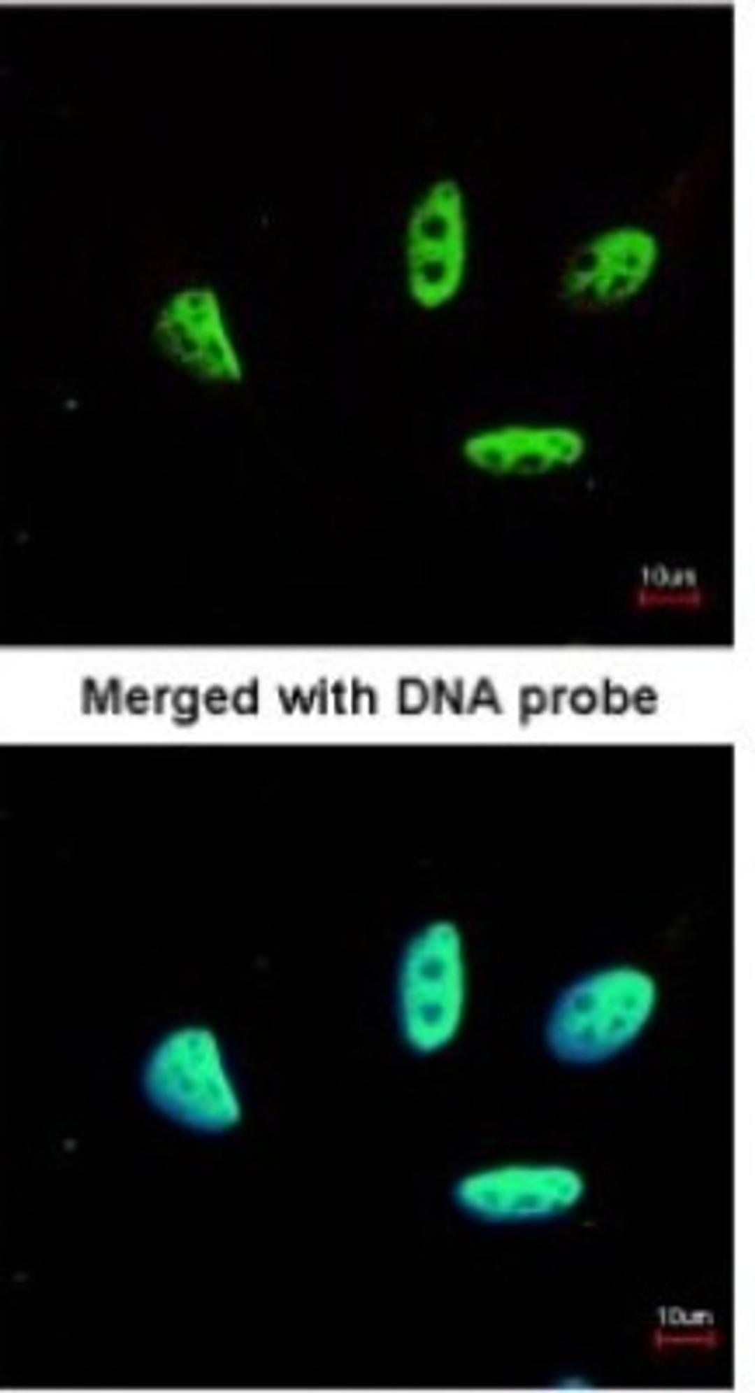 Immunocytochemistry/Immunofluorescence: LDB1 Antibody [NBP1-31362] - Paraformaldehyde-fixed HeLa, using antibody at 1:200 dilution.