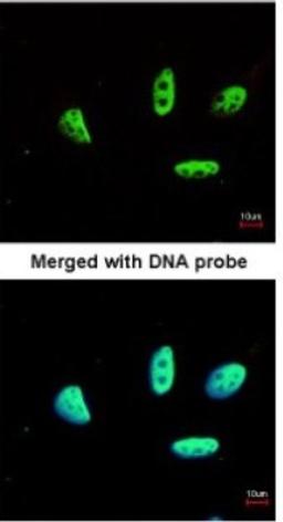 Immunocytochemistry/Immunofluorescence: LDB1 Antibody [NBP1-31362] - Paraformaldehyde-fixed HeLa, using antibody at 1:200 dilution.