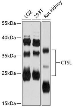 Western blot - CTSL antibody (A12200)