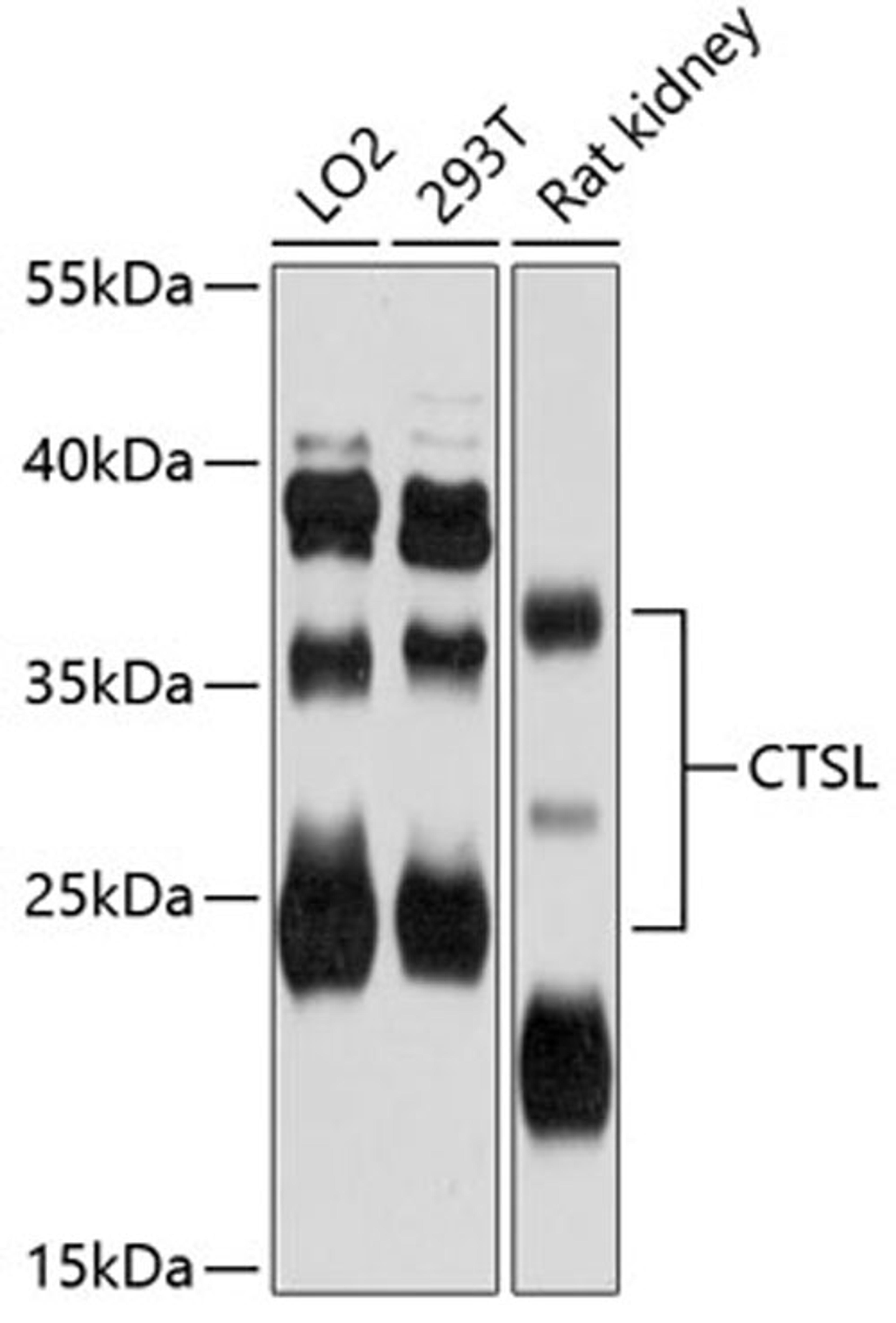 Western blot - CTSL antibody (A12200)