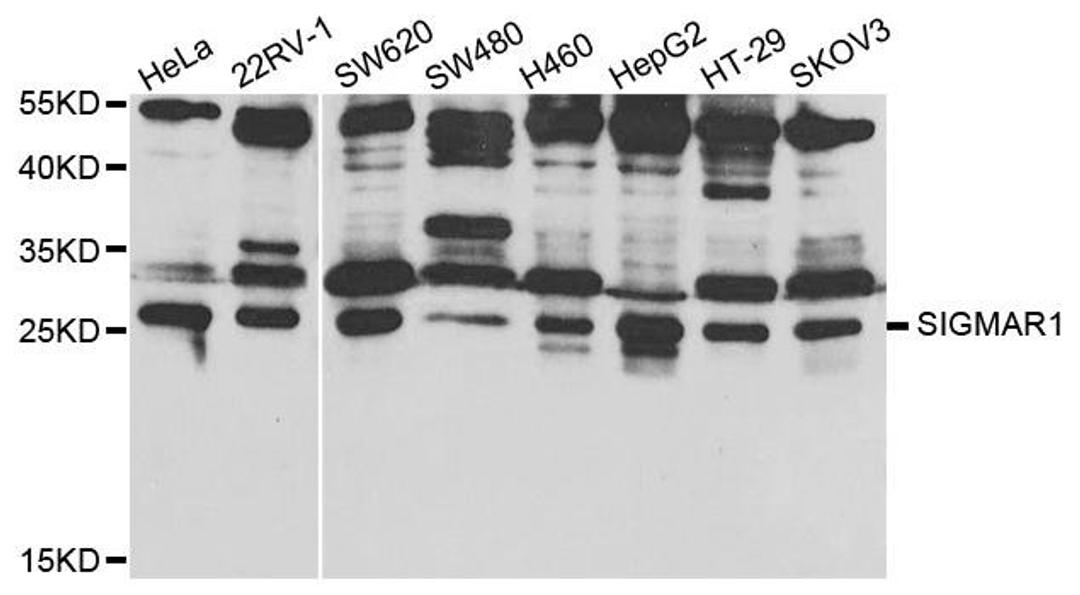 Western blot analysis of extracts of various cell lines using SIGMAR1 antibody