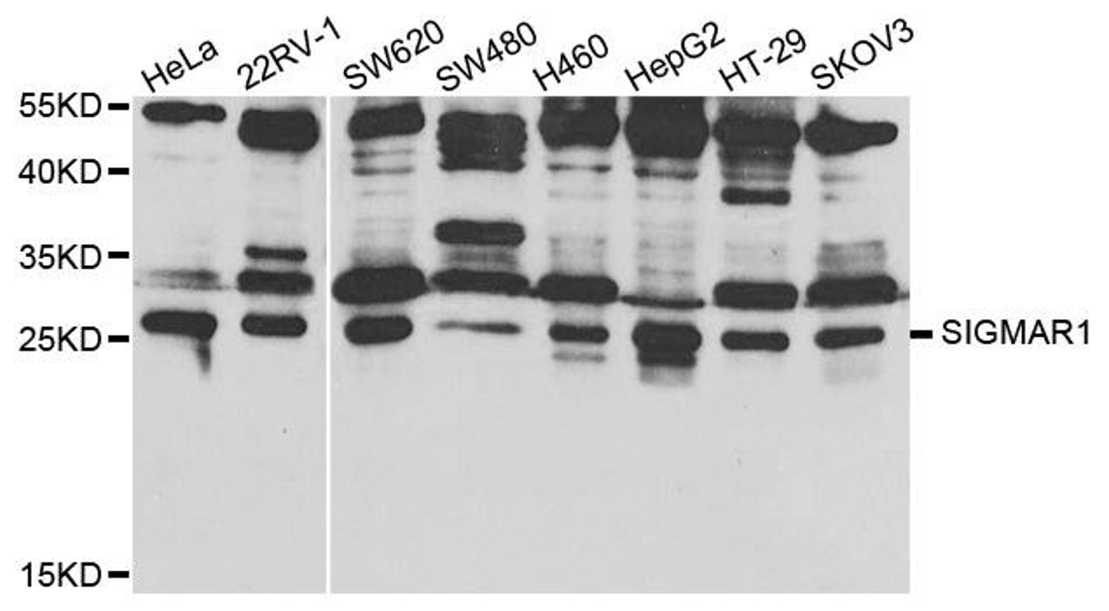 Western blot analysis of extracts of various cell lines using SIGMAR1 antibody