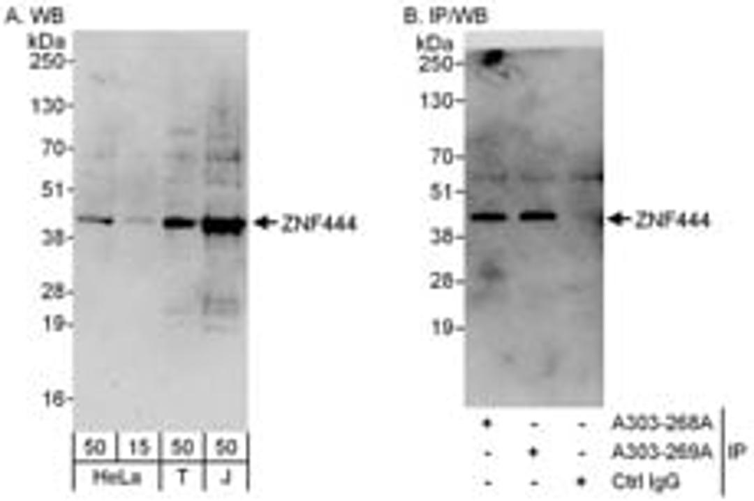 Detection of human ZNF444 by western blot and immunoprecipitation.