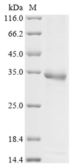 (Tris-Glycine gel) Discontinuous SDS-PAGE (reduced) with 5% enrichment gel and 15% separation gel.