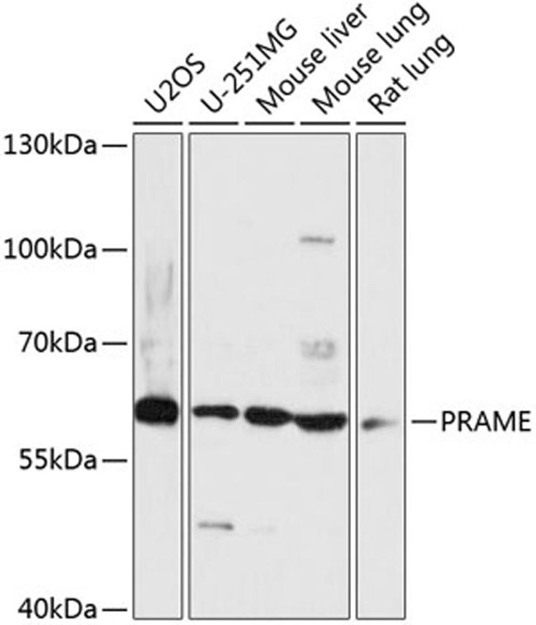 Western blot - PRAME antibody (A14507)