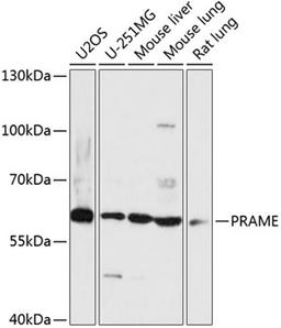 Western blot - PRAME antibody (A14507)