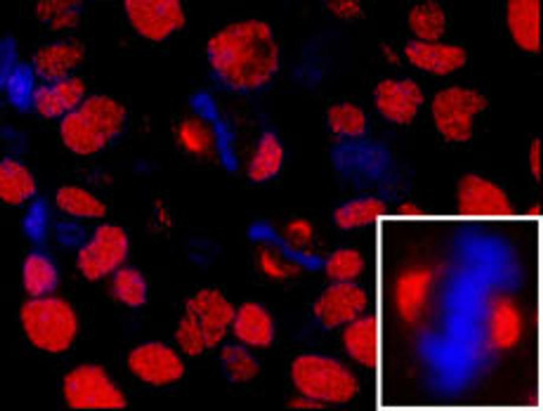 Detection of human NUMA by immunohistochemistry.