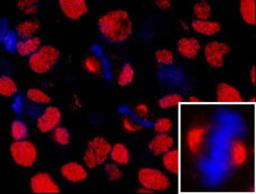 Detection of human NUMA by immunohistochemistry.