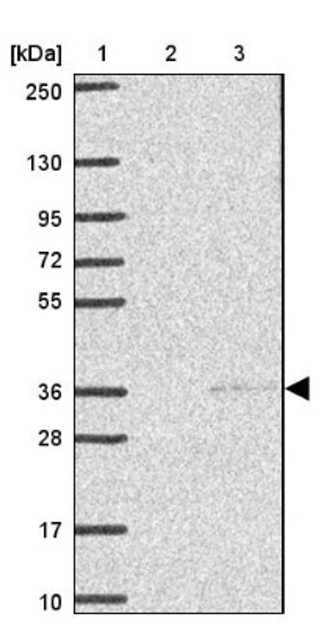 Western Blot: KCTD6 Antibody [NBP2-38281] - Lane 1: Marker [kDa] 250, 130, 95, 72, 55, 36, 28, 17, 10<br/>Lane 2: Negative Control<br/>Lane 3: LY407050