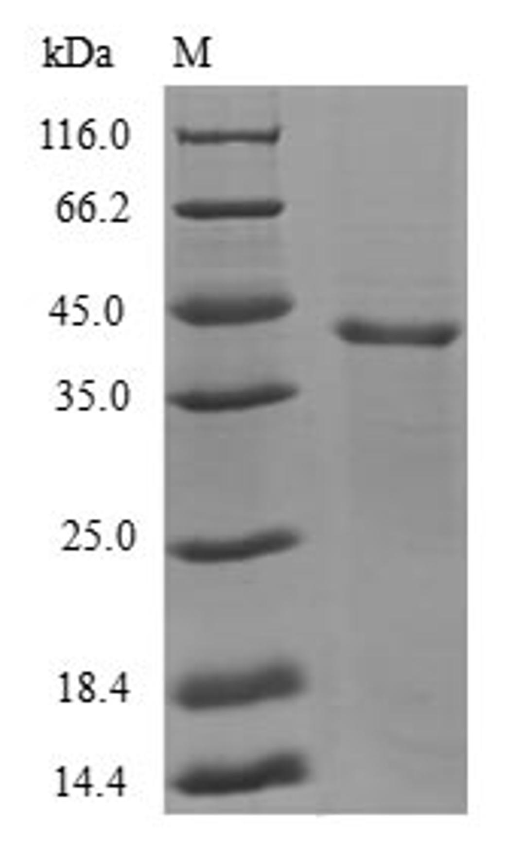 (Tris-Glycine gel) Discontinuous SDS-PAGE (reduced) with 5% enrichment gel and 15% separation gel.