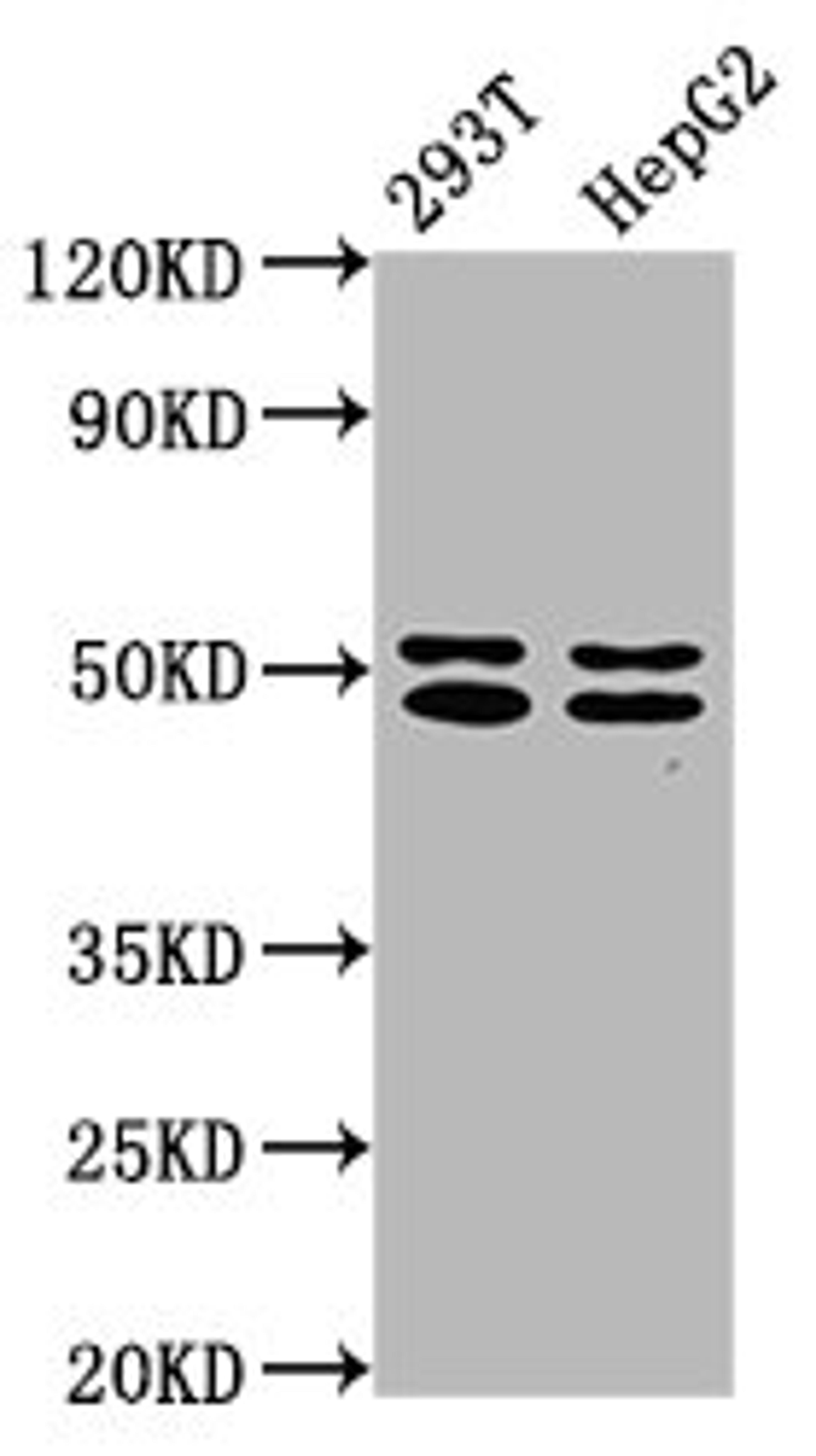 Western Blot. Positive WB detected in: 293T whole cell lysate, HepG2 whole cell lysate. All lanes: TRNT1 antibody at 5ug/ml. Secondary. Goat polyclonal to rabbit IgG at 1/50000 dilution. Predicted band size: 51, 48, 7 kDa. Observed band size: 51, 48 kDa. 
