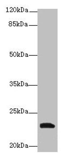 Western blot. All lanes: YKT6 antibody at 12µg/ml + A549 whole cell lysate. Secondary. Goat polyclonal to rabbit IgG at 1/10000 dilution. Predicted band size: 23, 19 kDa. Observed band size: 23 kDa