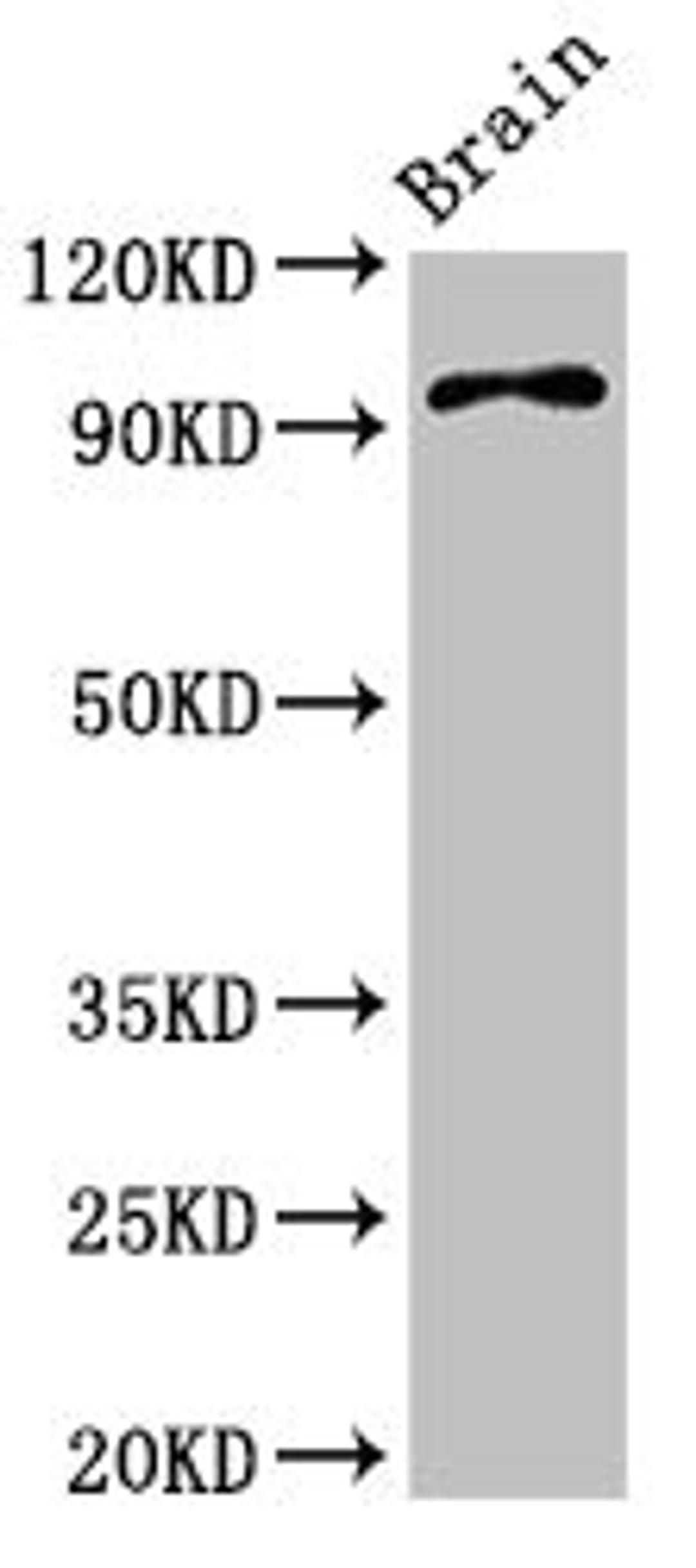 Western Blot. Positive WB detected in: Mouse brain tissue. All lanes: ABR antibody at 3.4ug/ml. Secondary. Goat polyclonal to rabbit IgG at 1/50000 dilution. Predicted band size: 98, 94, 36, 93 kDa. Observed band size: 98 kDa.