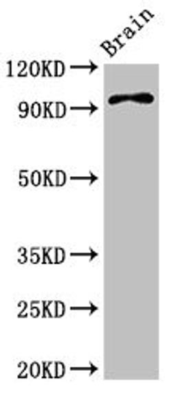 Western Blot. Positive WB detected in: Mouse brain tissue. All lanes: ABR antibody at 3.4ug/ml. Secondary. Goat polyclonal to rabbit IgG at 1/50000 dilution. Predicted band size: 98, 94, 36, 93 kDa. Observed band size: 98 kDa.