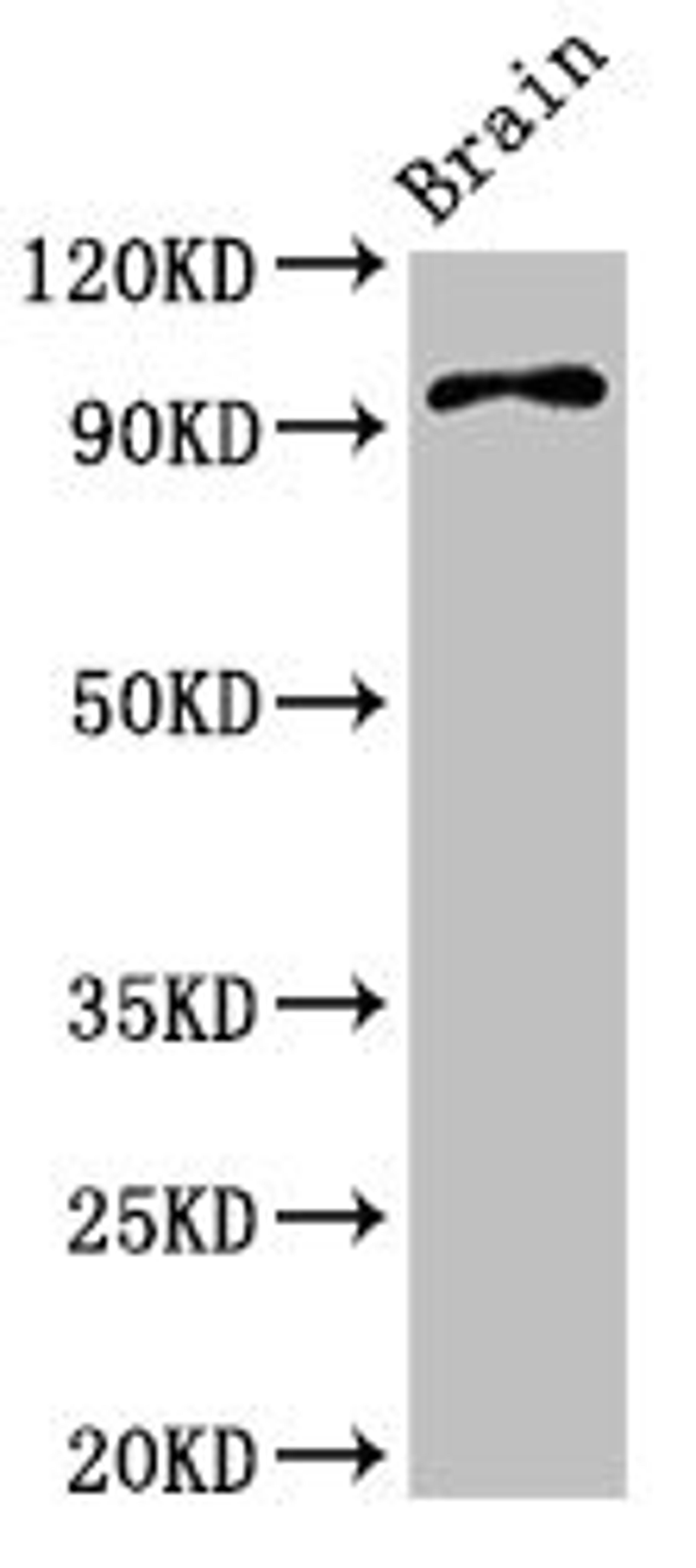 Western Blot. Positive WB detected in: Mouse brain tissue. All lanes: ABR antibody at 3.4ug/ml. Secondary. Goat polyclonal to rabbit IgG at 1/50000 dilution. Predicted band size: 98, 94, 36, 93 kDa. Observed band size: 98 kDa.