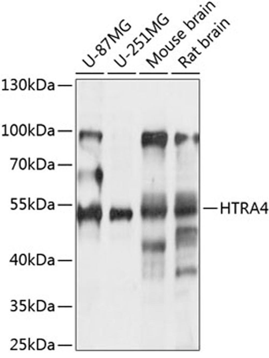 Western blot - HTRA4 antibody (A14314)