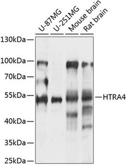 Western blot - HTRA4 antibody (A14314)