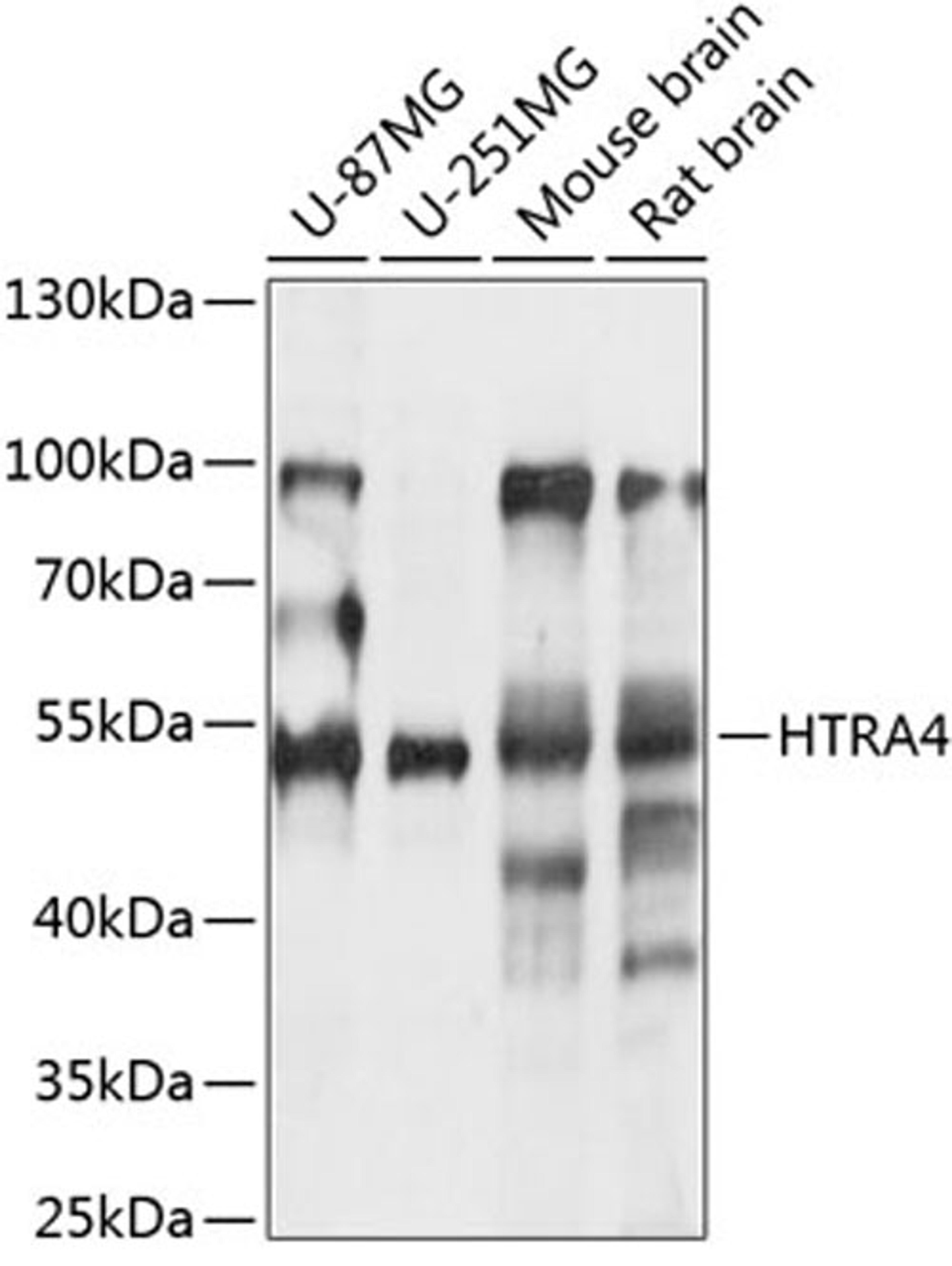 Western blot - HTRA4 antibody (A14314)