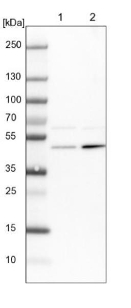 Western Blot: Adenylosuccinate Synthase Antibody [NBP1-90360] - Lane 1: NIH-3T3 cell lysate (Mouse embryonic fibroblast cells)<br/>Lane 2: NBT-II cell lysate (Rat Wistar bladder tumour cells)