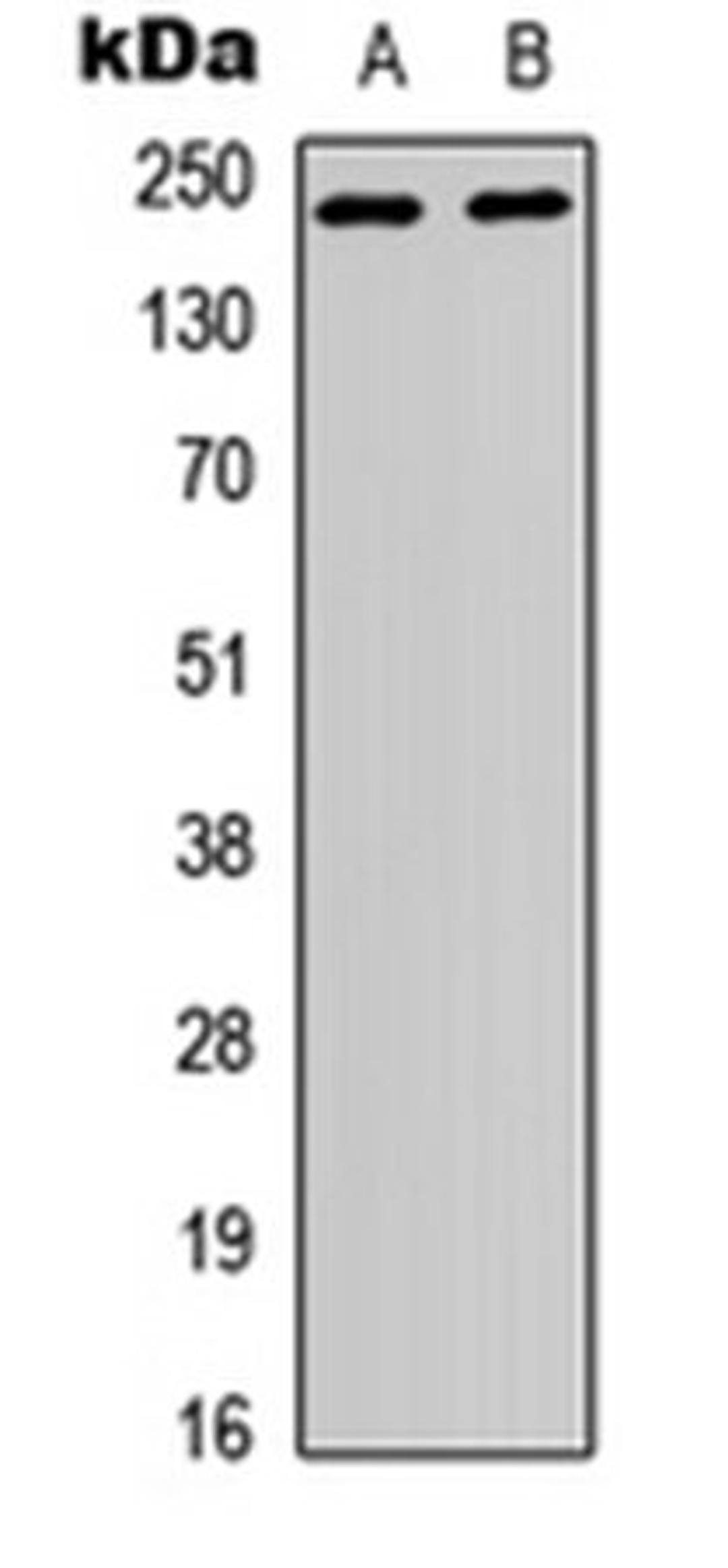 Western blot analysis of HEK293T (Lane 1), HeLa (Lane 2) whole cell lysates using p65 antibody