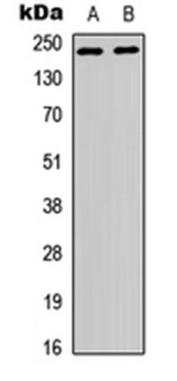 Western blot analysis of HEK293T (Lane 1), HeLa (Lane 2) whole cell lysates using p65 antibody