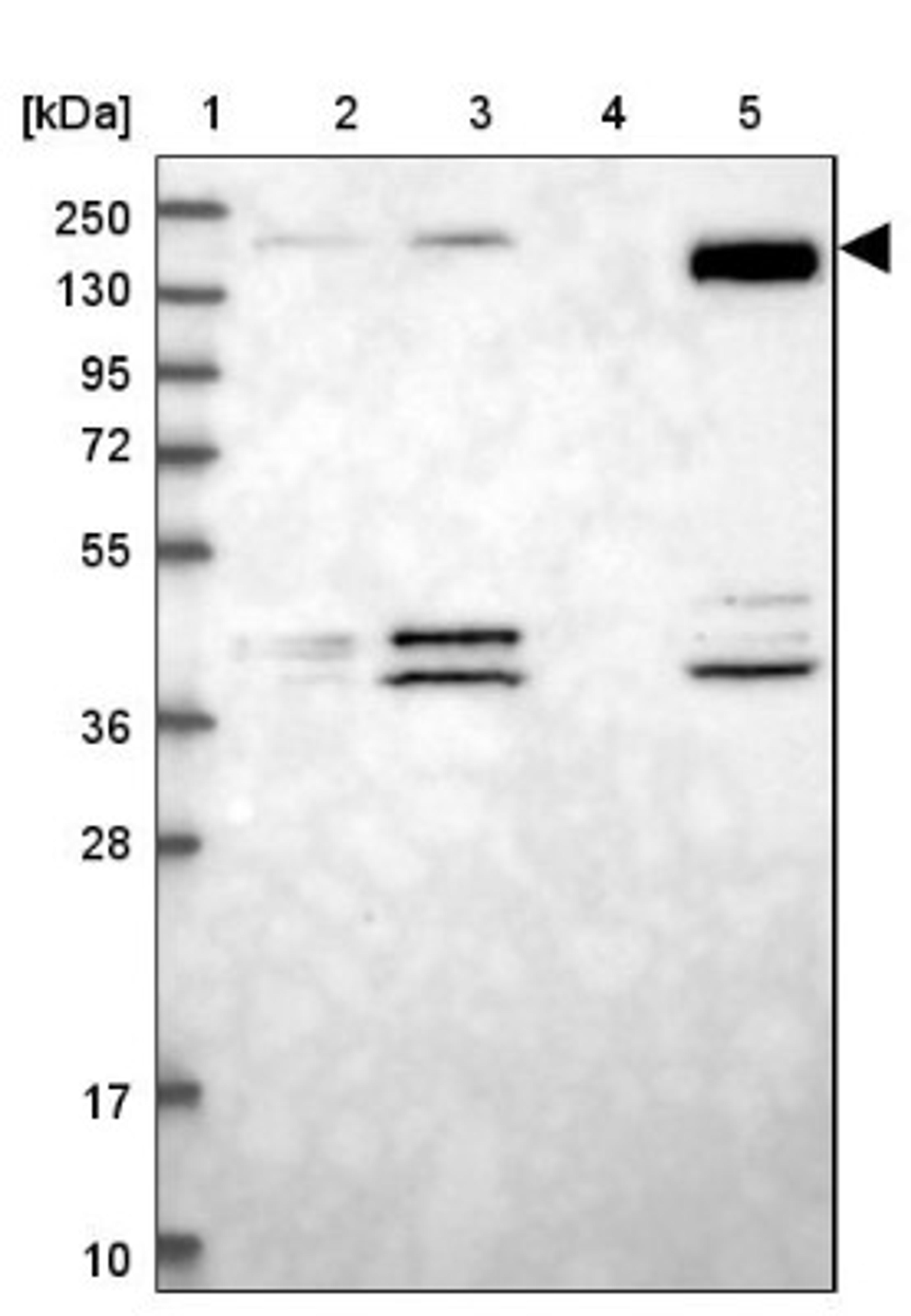 Western Blot: BPIL2 Antibody [NBP2-38507] - Lane 1: Marker [kDa] 250, 130, 95, 72, 55, 36, 28, 17, 10<br/>Lane 2: RT-4<br/>Lane 3: U-251 MG<br/>Lane 4: Human Plasma<br/>Lane 5: Liver