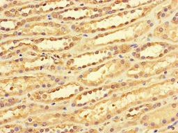 Immunohistochemistry of paraffin-embedded human kidney tissue using CSB-PA006482LA01HU at dilution of 1:100