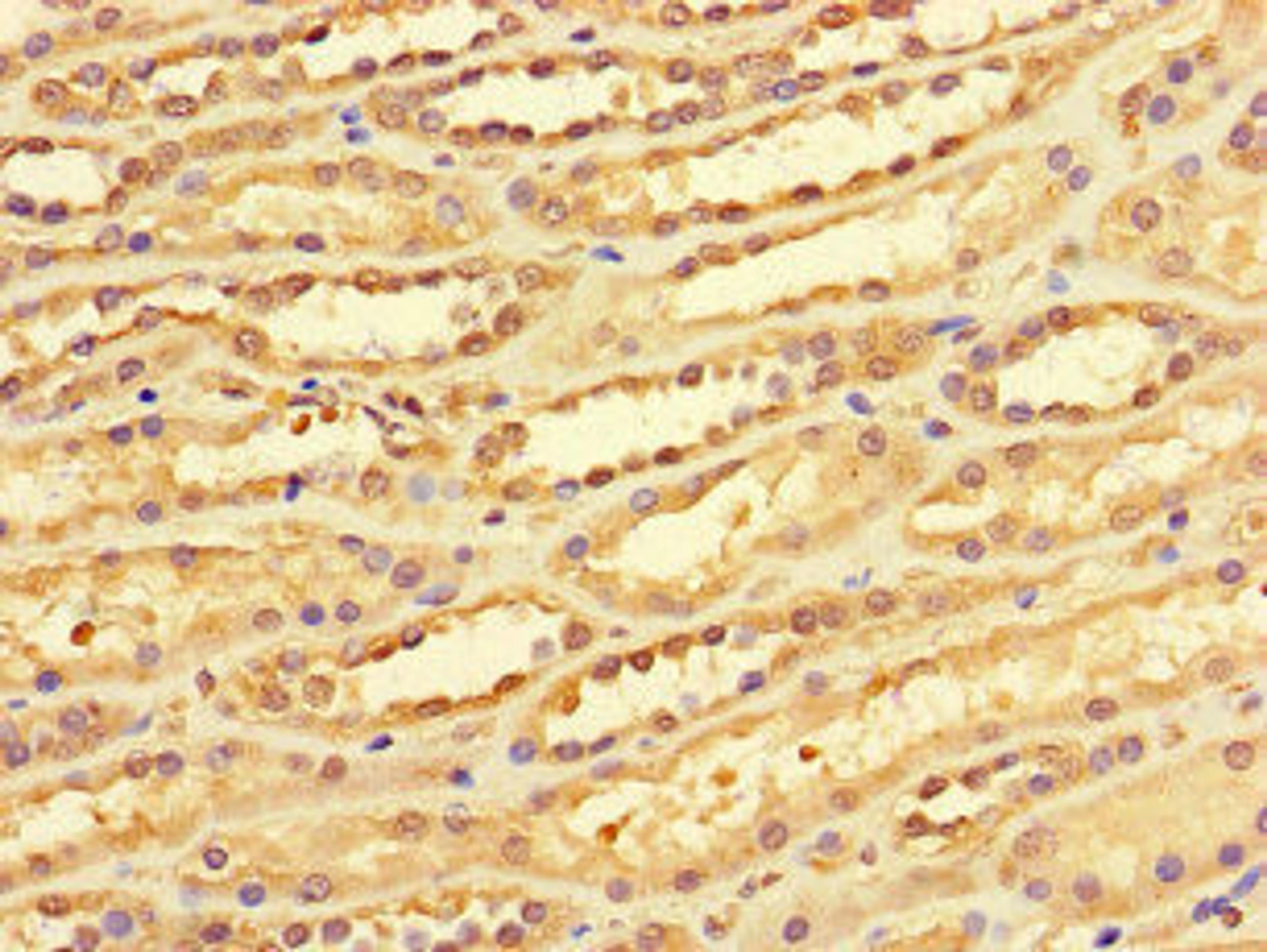 Immunohistochemistry of paraffin-embedded human kidney tissue using CSB-PA006482LA01HU at dilution of 1:100