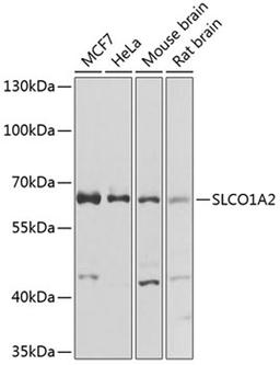 Western blot - SLCO1A2 antibody (A8452)