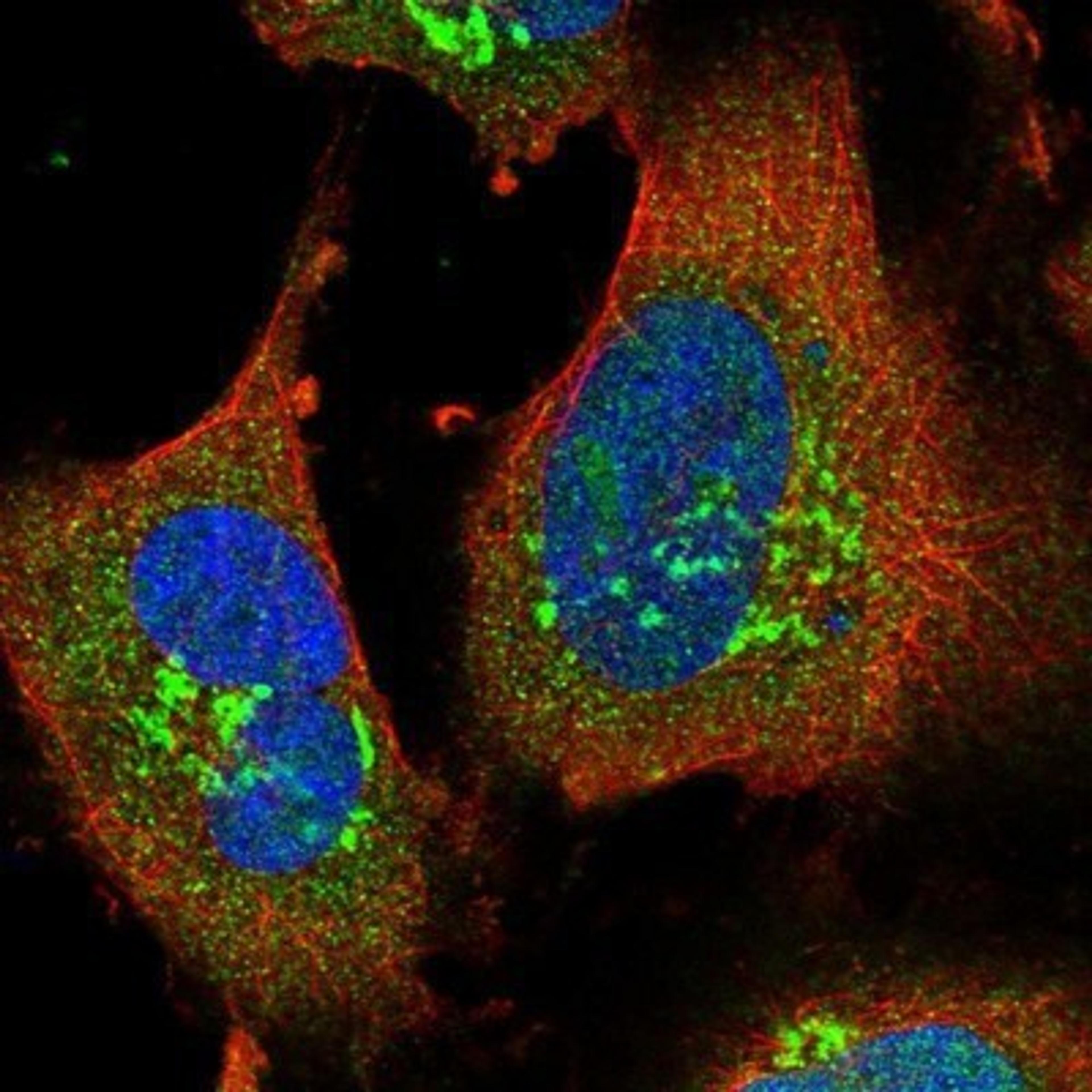 Immunocytochemistry/Immunofluorescence: COL4A3BP Antibody [NBP1-85681] - Staining of human cell line U-251 MG shows positivity in nucleus but not nucleoli & golgi apparatus.