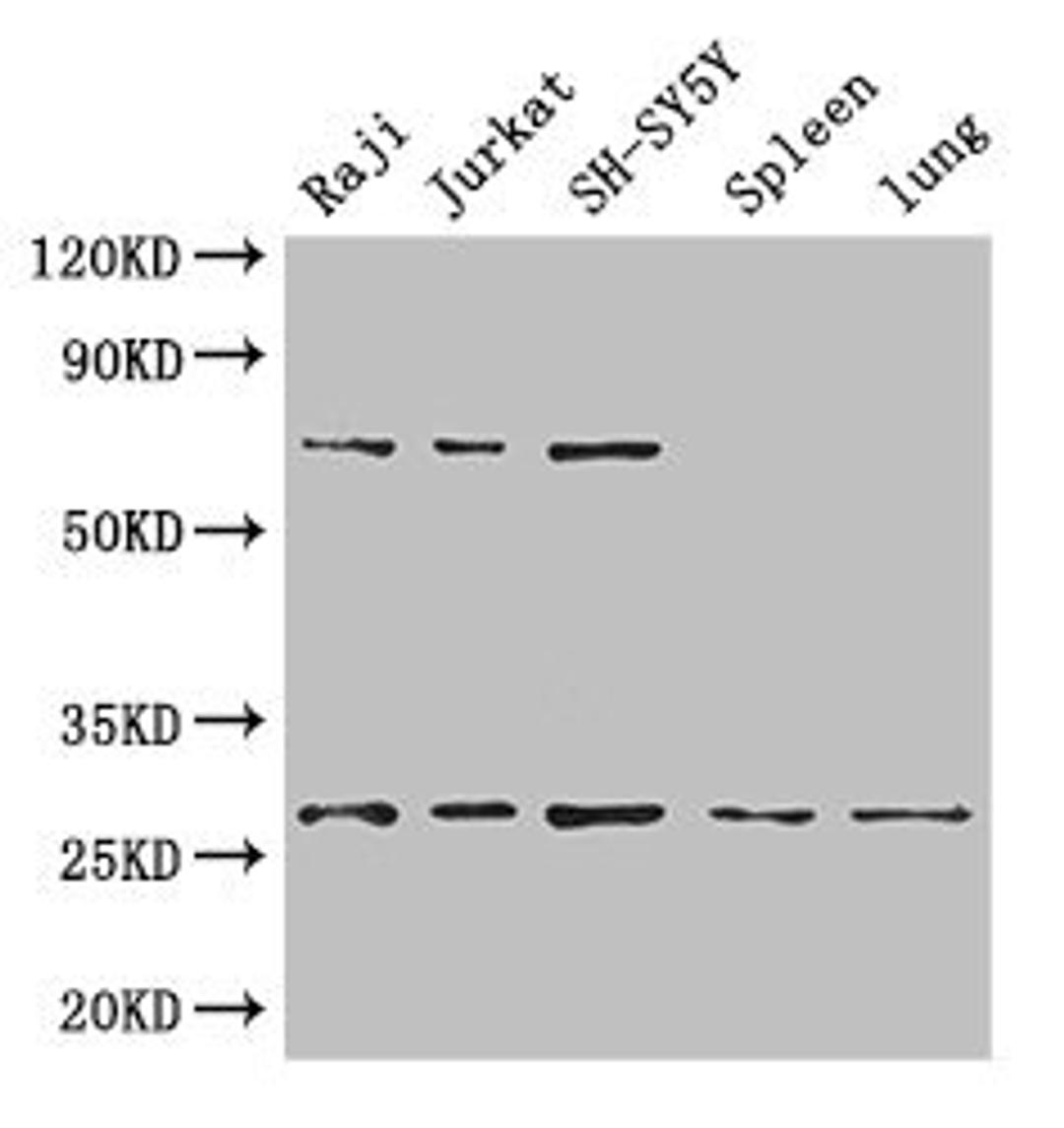 Western Blot. Positive WB detected in: Raji whole cell lysate, Jurkat whole cell lysate, SH-SY5Y whole cell lysate, Mouse spleen tissue, Mouse lung tissue. All lanes: YWHAZ antibody at 3.4µg/ml. Secondary. Goat polyclonal to rabbit IgG at 1/50000 dilution. Predicted band size: 28, 20 kDa. Observed band size: 28, 70 kDa