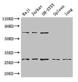 Western Blot. Positive WB detected in: Raji whole cell lysate, Jurkat whole cell lysate, SH-SY5Y whole cell lysate, Mouse spleen tissue, Mouse lung tissue. All lanes: YWHAZ antibody at 3.4µg/ml. Secondary. Goat polyclonal to rabbit IgG at 1/50000 dilution. Predicted band size: 28, 20 kDa. Observed band size: 28, 70 kDa