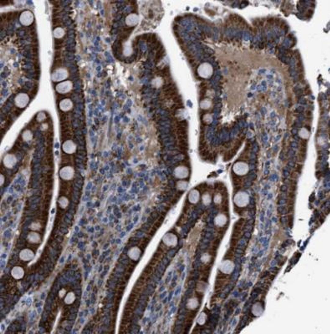 Immunohistochemistry-Paraffin: GITR Ligand/TNFSF18 Antibody [NBP1-90198] - Staining of human duodenum shows cytoplasmic positivity in glandular cells.