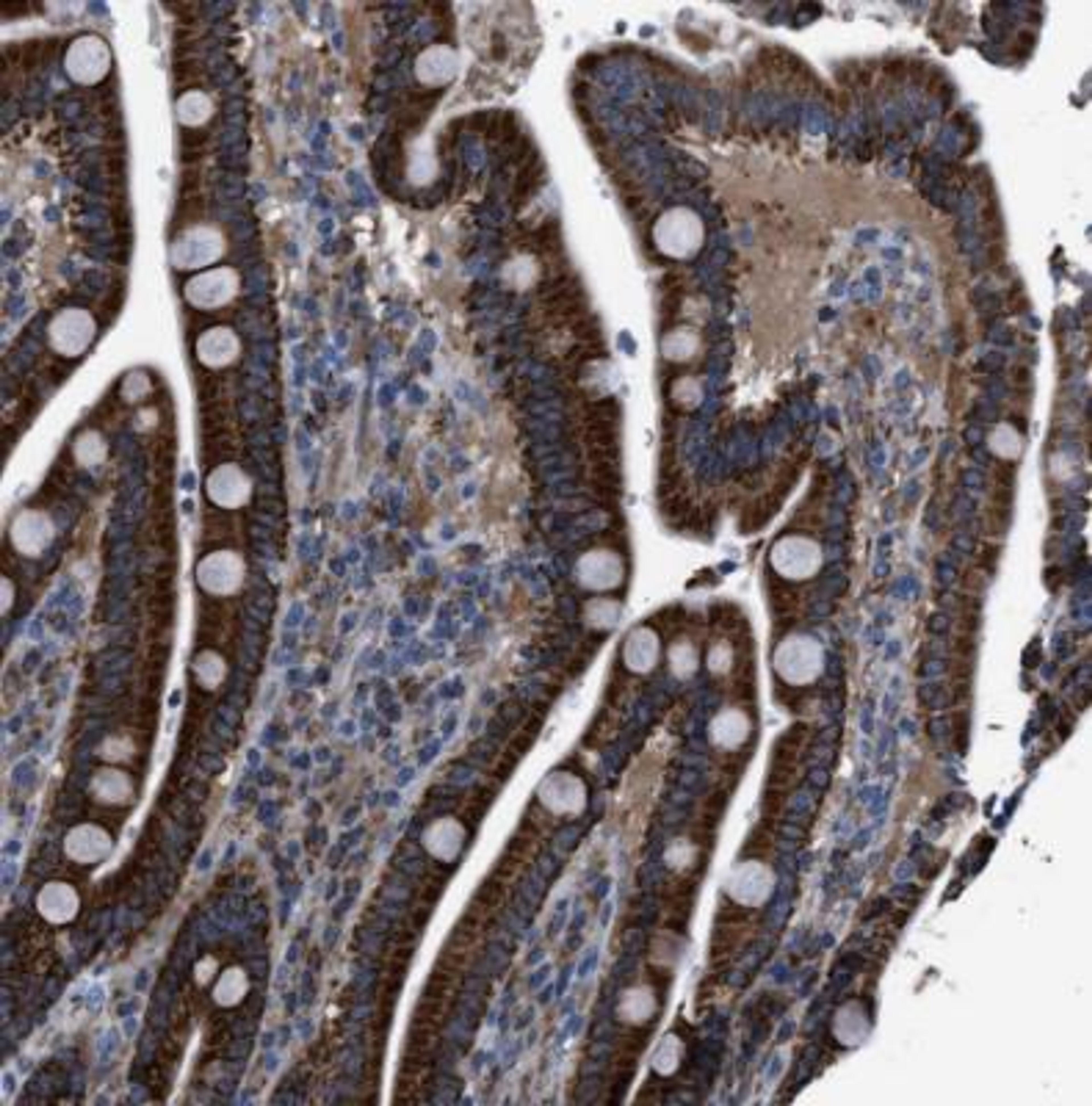 Immunohistochemistry-Paraffin: GITR Ligand/TNFSF18 Antibody [NBP1-90198] - Staining of human duodenum shows cytoplasmic positivity in glandular cells.