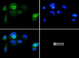 Immunocytochemistry/Immunofluorescence: PGP9.5 / UCHL-1 Antibody [NB300-676] - in Neuro2a cells with FITC (green). Nuclei were counterstained with Dapi (blue).