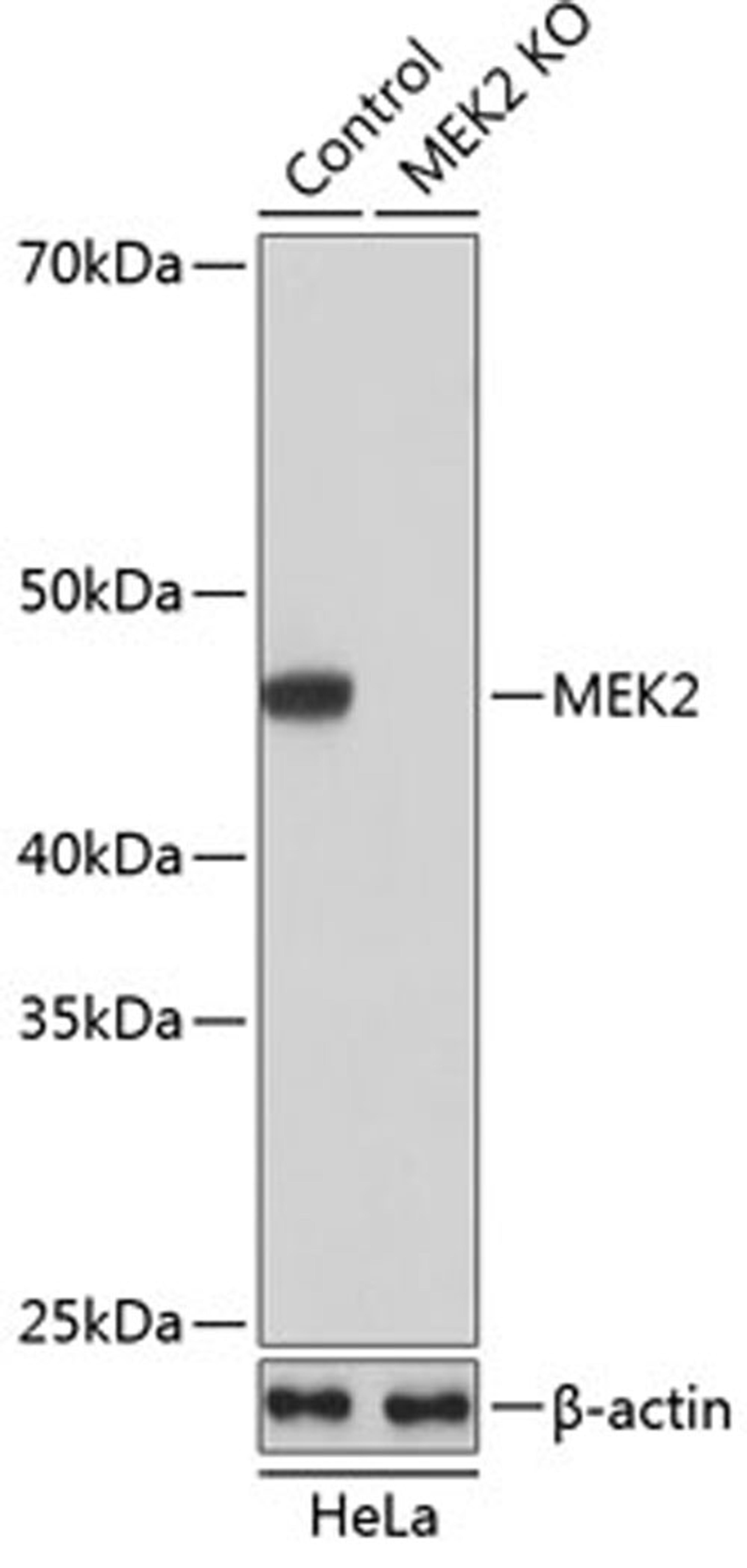 Western blot - MEK2 antibody (A19078)