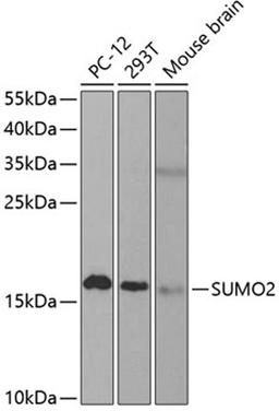 Western blot - SUMO2 antibody (A2571)