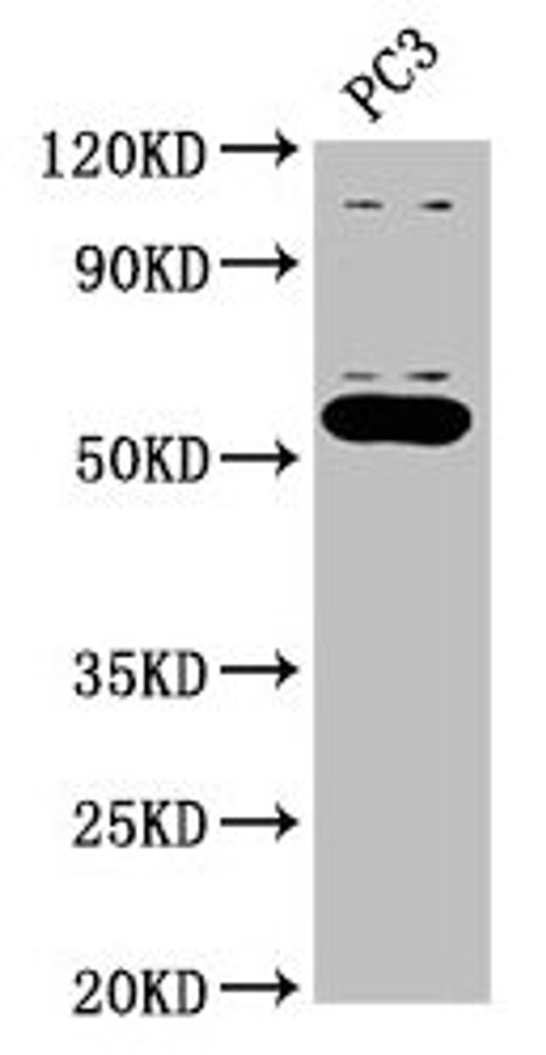 Western Blot. Positive WB detected in: PC-3 whole cell lysate. All lanes: OMA1 antibody at 2.7µg/ml. Secondary. Goat polyclonal to rabbit IgG at 1/50000 dilution. Predicted band size: 61, 56 kDa. Observed band size: 56 kDa