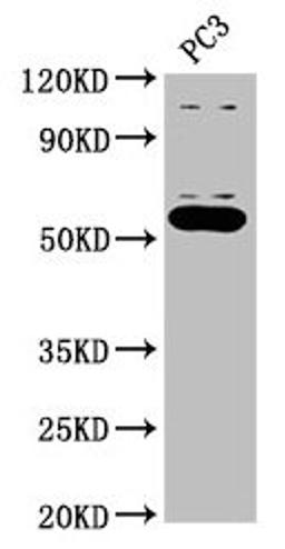 Western Blot. Positive WB detected in: PC-3 whole cell lysate. All lanes: OMA1 antibody at 2.7µg/ml. Secondary. Goat polyclonal to rabbit IgG at 1/50000 dilution. Predicted band size: 61, 56 kDa. Observed band size: 56 kDa