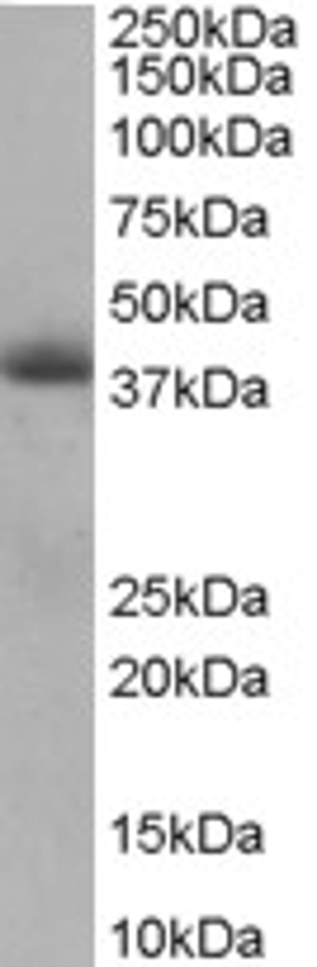 46-496 staining (0.5ug/ml) of Human Heart lysate (RIPA buffer, 35ug total protein per lane). Primary incubated for 1 hour. Detected by chemiluminescence.