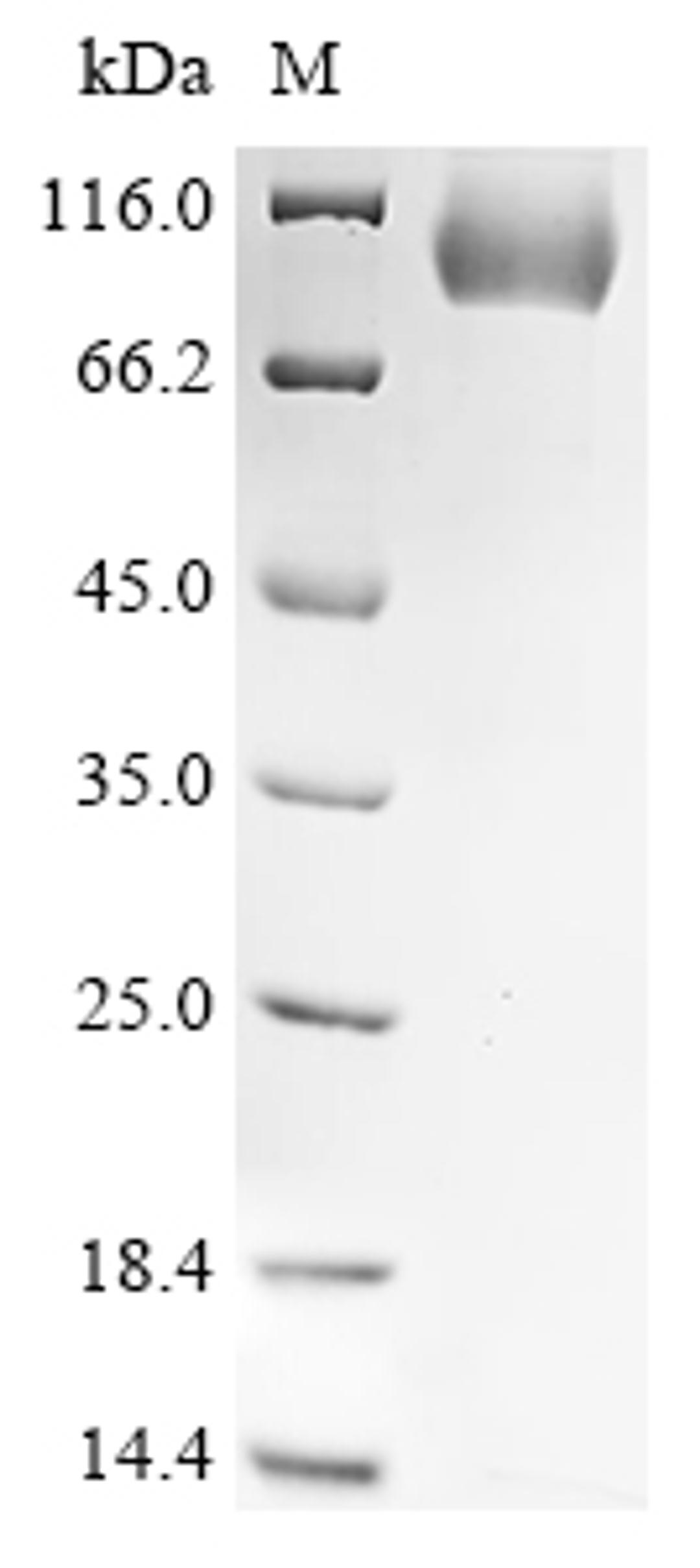 (Tris-Glycine gel) Discontinuous SDS-PAGE (reduced) with 5% enrichment gel and 15% separation gel.