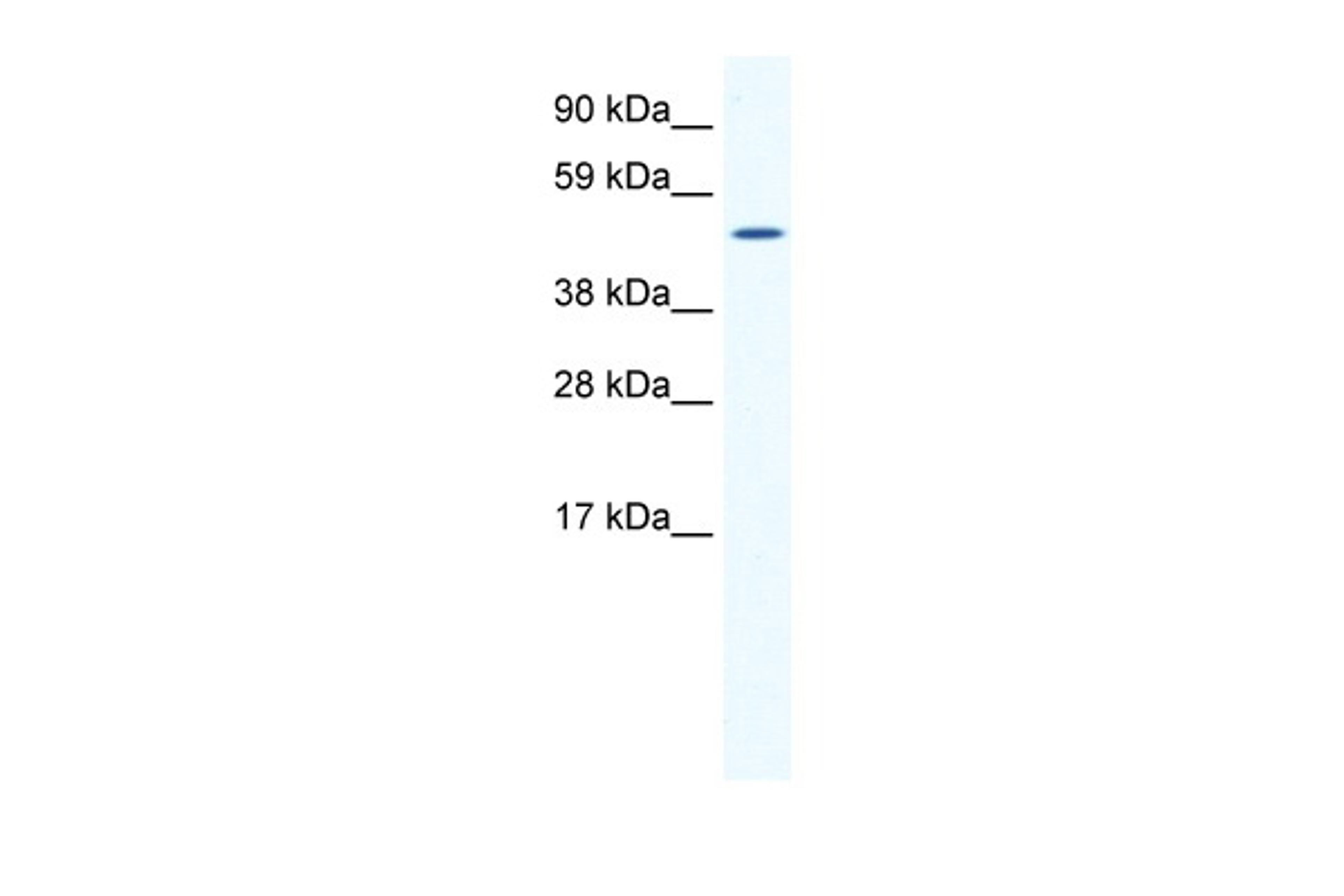 Antibody used in WB on Mouse SP2/0 at 1.25 ug/ml.