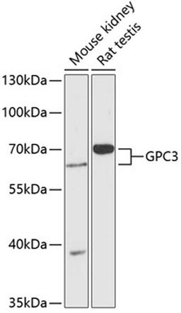 Western blot - GPC3 antibody (A13988)