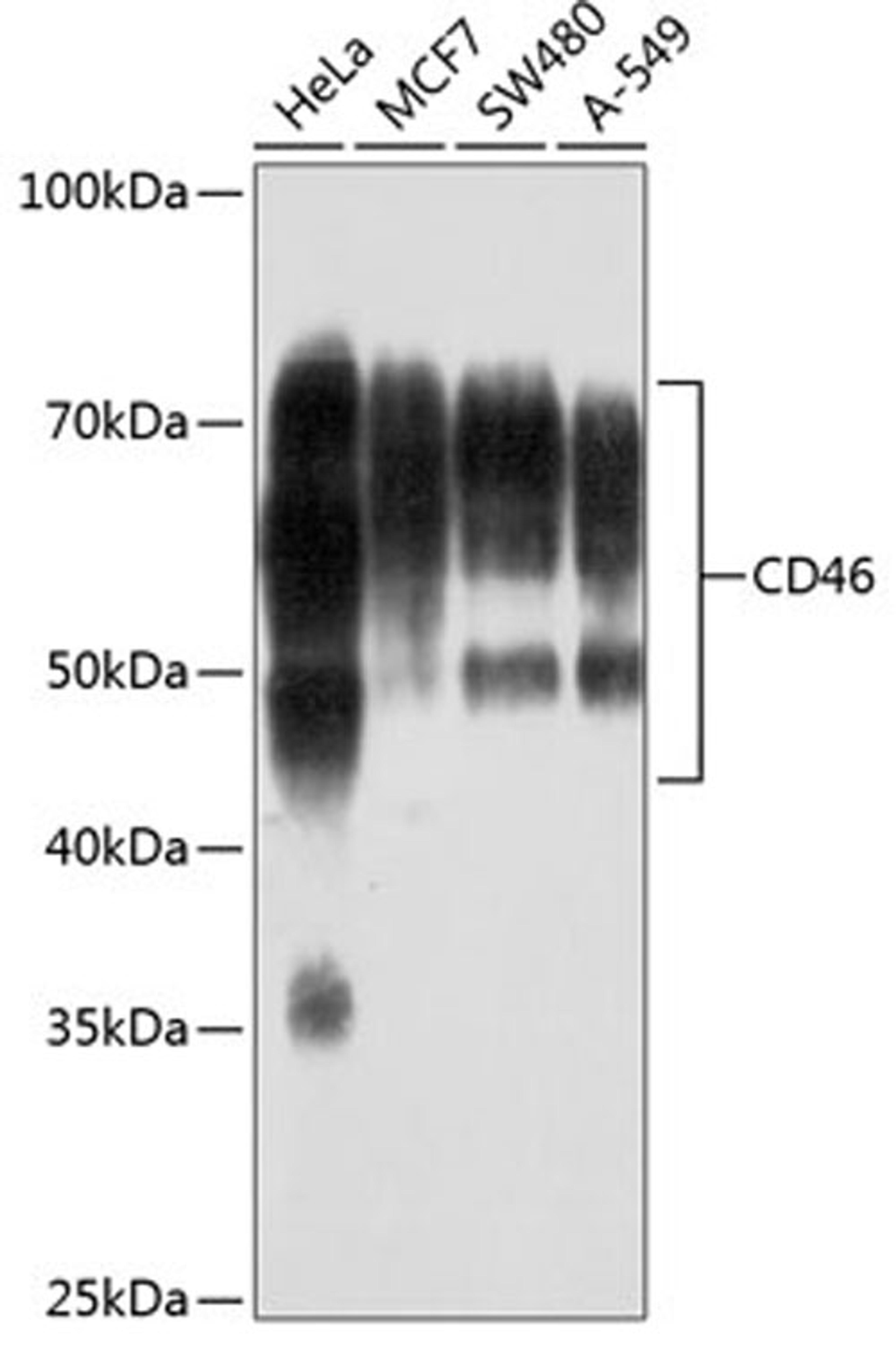 Western blot - CD46 antibody (A19022)