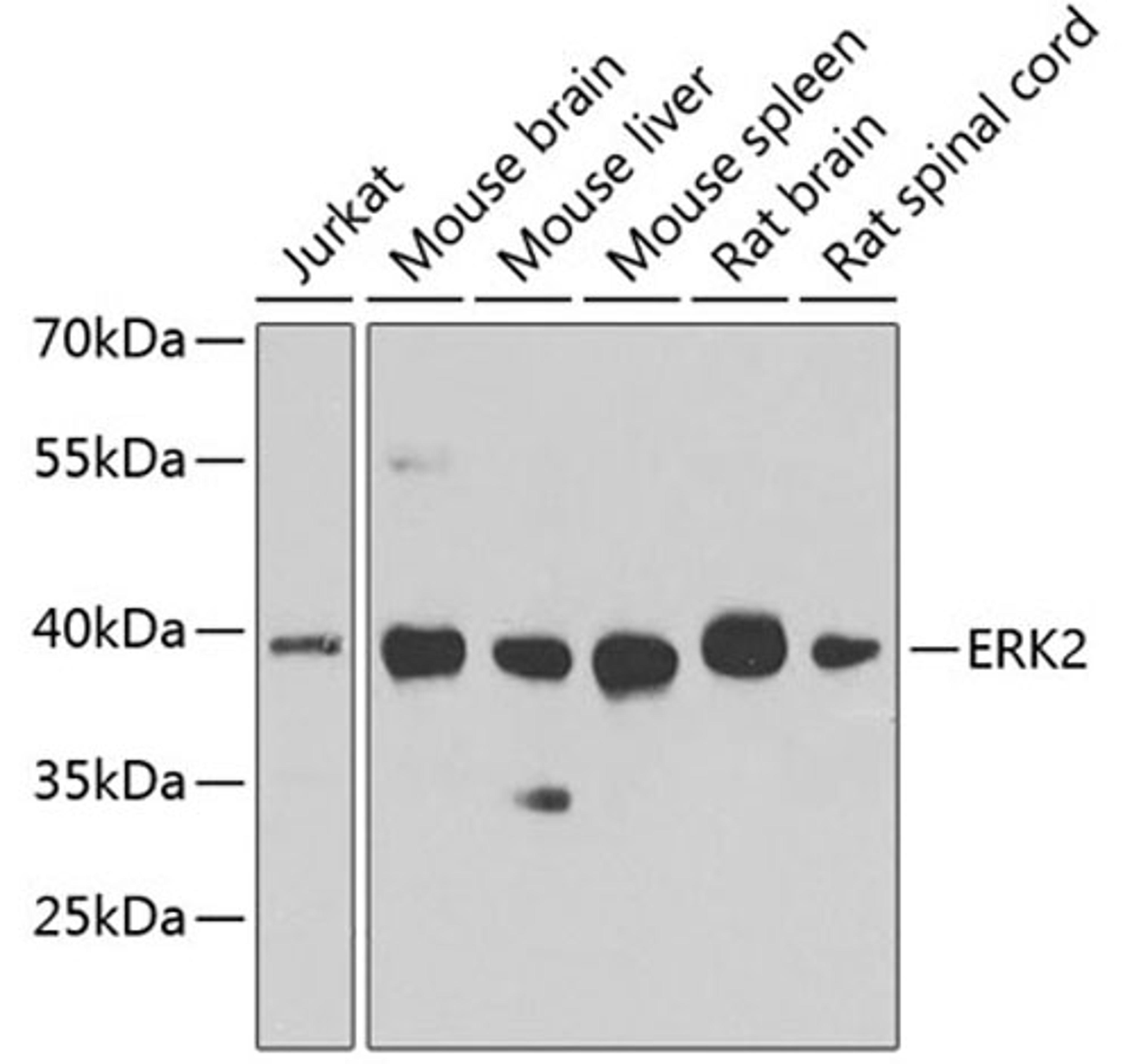 Western blot - ERK2 antibody (A11186)