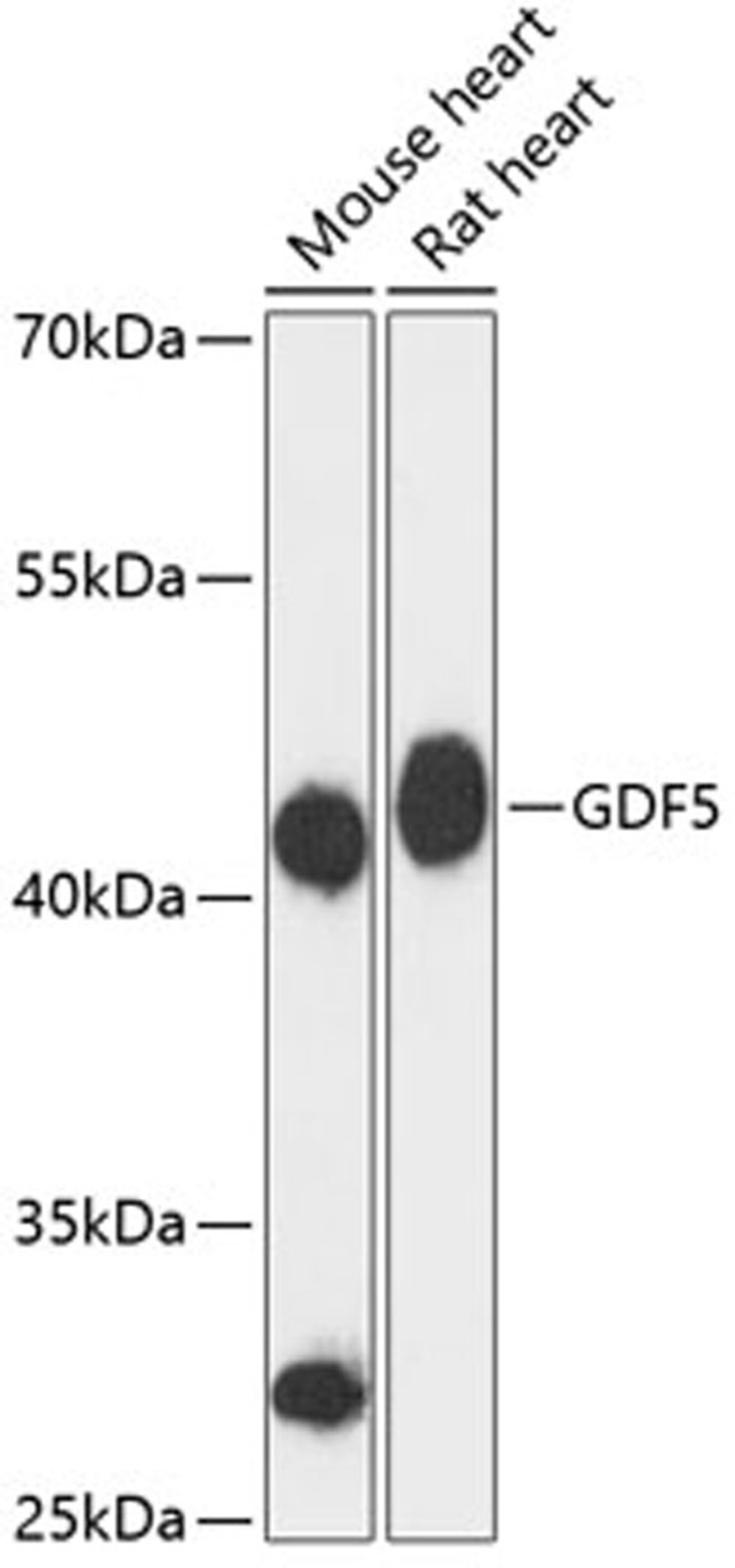 Western blot - GDF5 antibody (A13167)