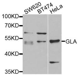 Western blot analysis of extracts of various cells using GLA antibody