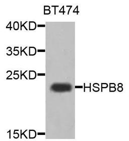 Western blot analysis of extracts of BT474 cells using HSPB8 antibody